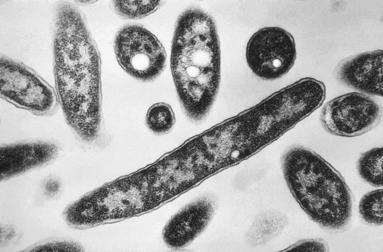 Death toll from Legionnaires’ disease rises to 16 in southeast Poland close to Ukraine border